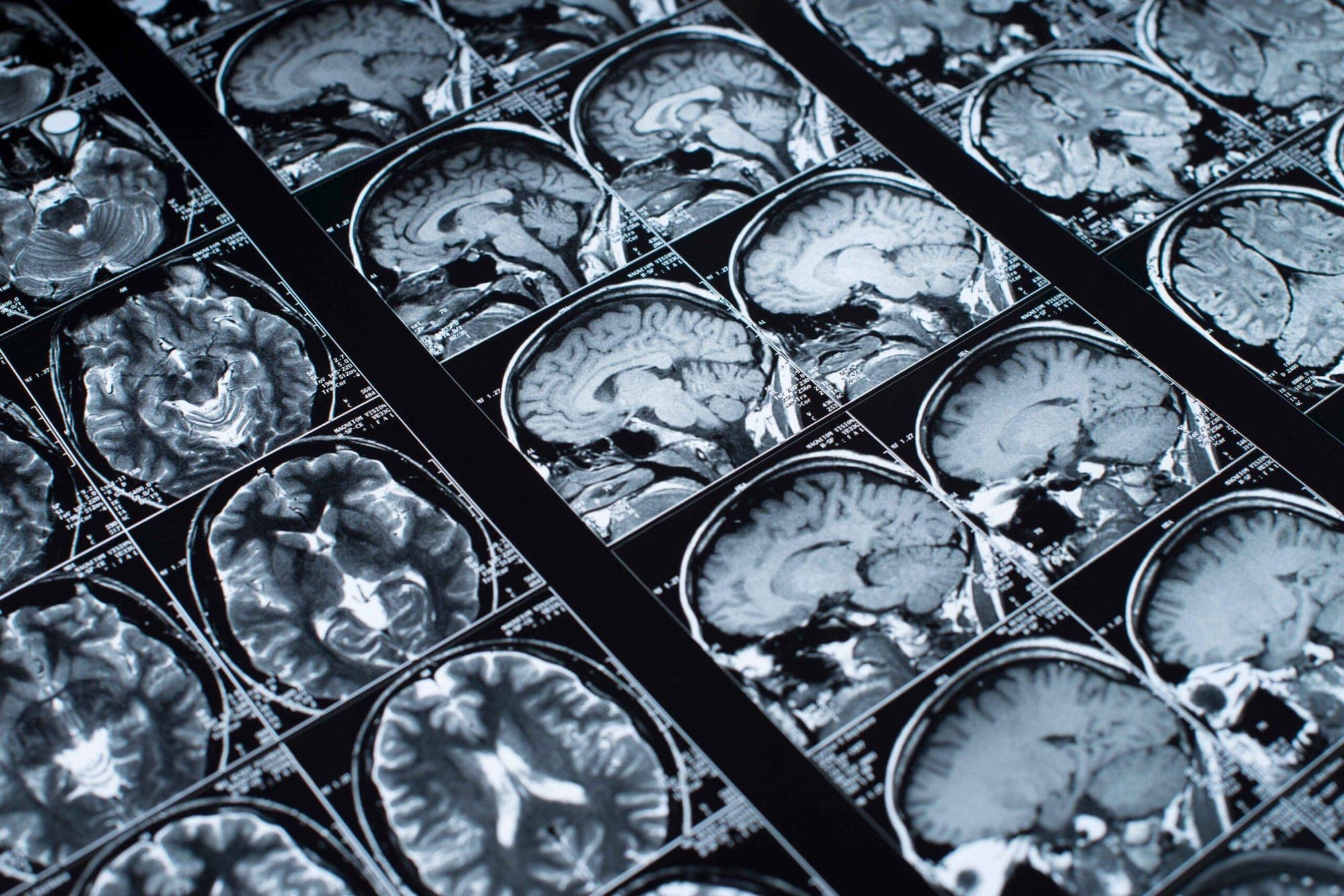 ULF MRI Technology represented in an image.