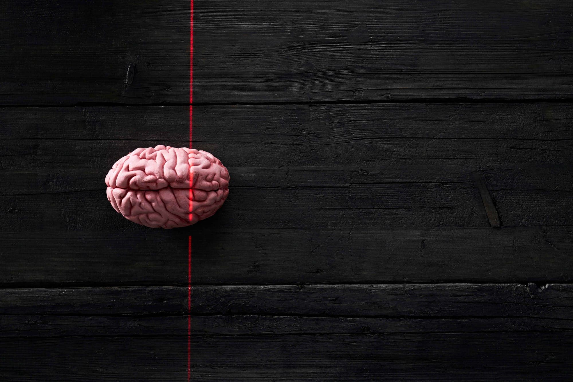 Neuromarketing in Forex represented in an image.