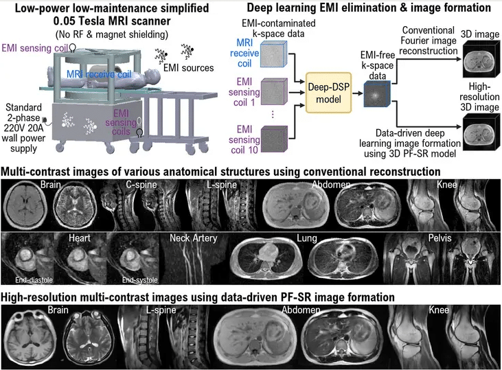 ULF MRI Technology